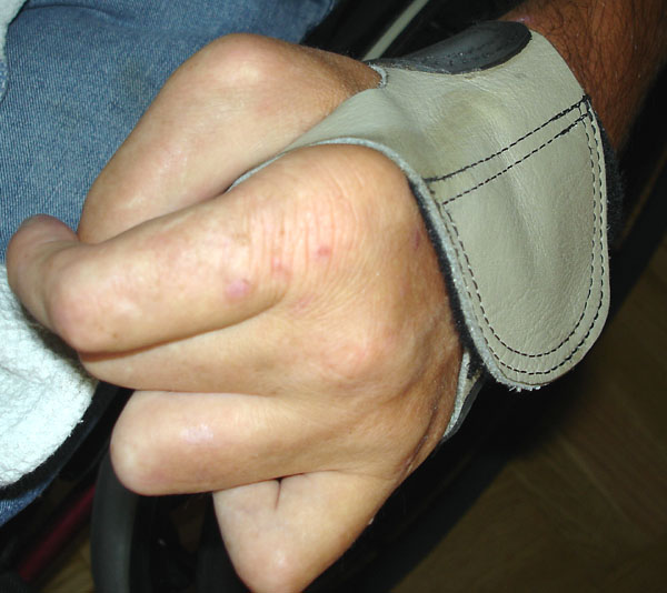 Rullstolhandskar på användarens hand