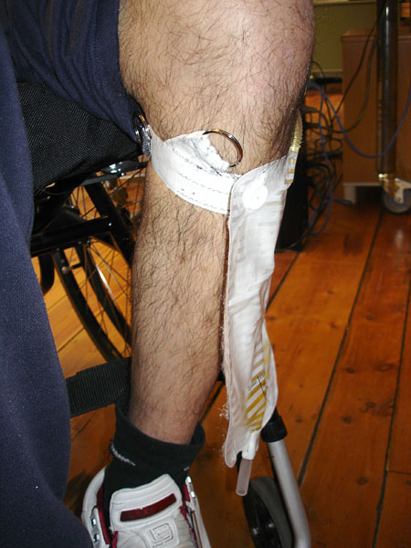 User with adapted attachment strap and urine bag