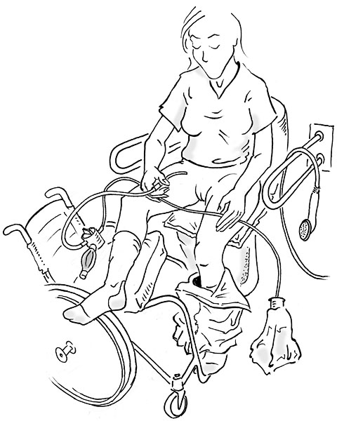 User with Peristeen. Illustration: Lars 'Geson' Anderson