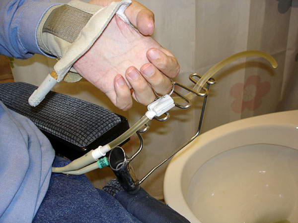 The urine tube is in the holder (potatoe masher). The user's middle finger is in the key ring of the urine tube valve.