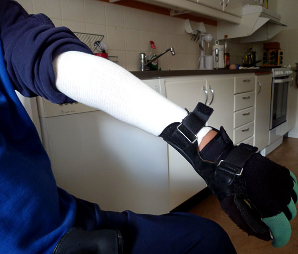 User wearing tube bandage and glove